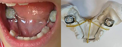 口腔牙齒保健